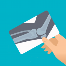 Client Receives £200,000.00 Following a Medical Error Caused During Elbow Surgery