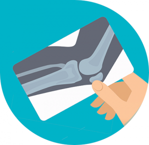 Client Receives £200,000.00 Following a Medical Error Caused During Elbow Surgery